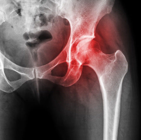 Show 1468: Healing Joints and Nerves: The New Science of Regenerative Therapies