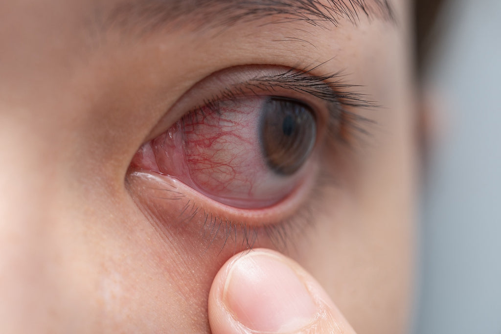 Show 1475: Your Allergy Survival Guide: What Works, What Doesn't, What's Risky