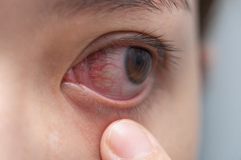 Show 1475: Your Allergy Survival Guide: What Works, What Doesn't, What's Risky