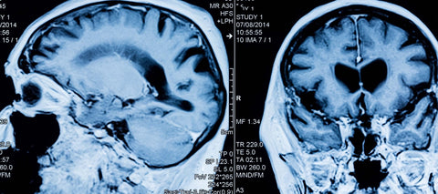 Show 1428: The Hidden Power of the Unconscious Brain