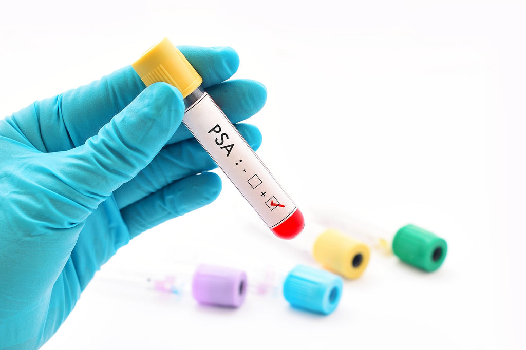 Show 1439: What Men Need to Know to Overcome Prostate Cancer