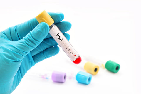 Show 1439: What Men Need to Know to Overcome Prostate Cancer